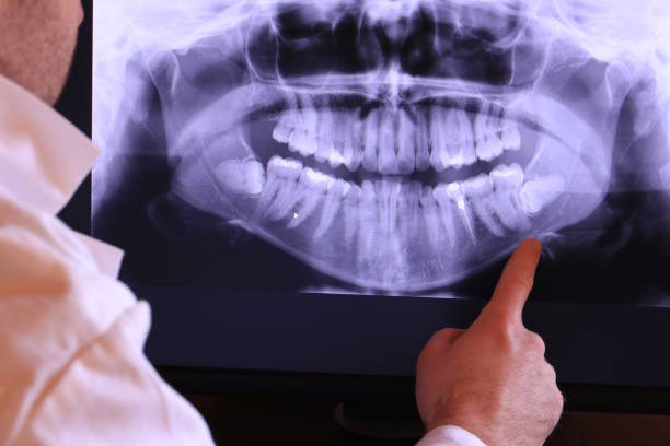 Best Broken or Cracked Tooth Emergency Dentist in Wood Ridge, NJ